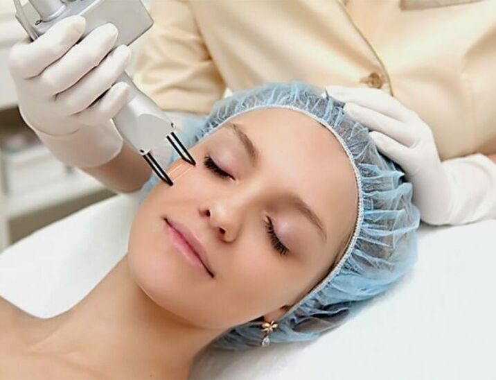 Action laser fractionnée sur la peau du visage pour un rajeunissement en douceur