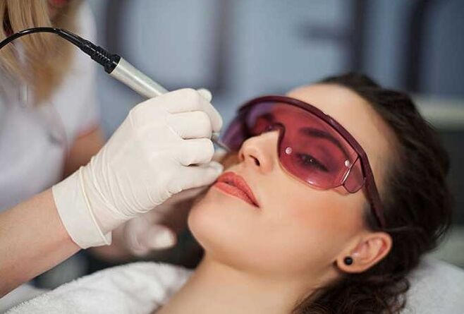 Biorétisation laser