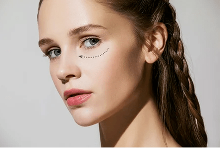 Correction de la zone autour des yeux