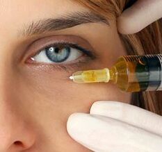 Rajeunissement d'injection des paupières