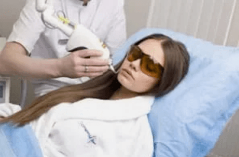 rajeunissement fractionné au laser