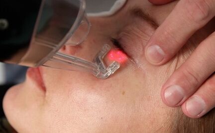 Procédure de rajeunissement de la peau du visage au laser