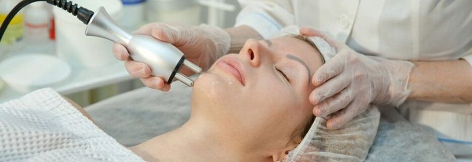 Procédure de rajeunissement fractionné de la peau du visage au laser