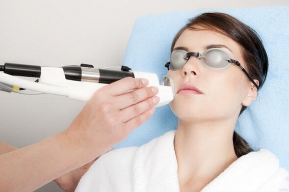 Effectuer un rajeunissement de la peau au laser